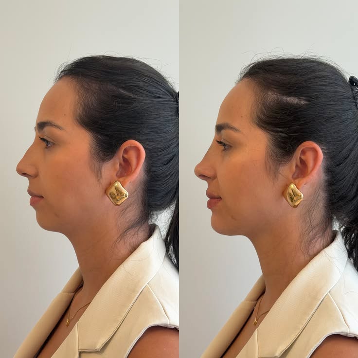 Signature Bright Facial